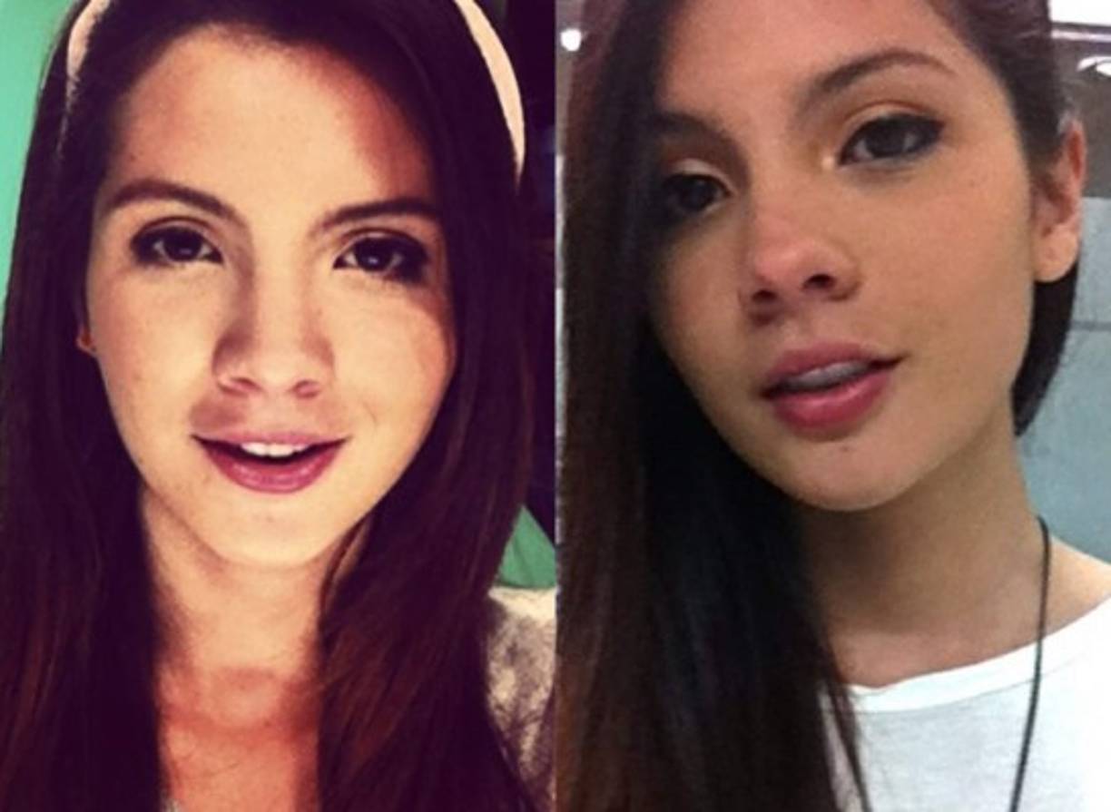 Sus padres, Juan Carlos Arbeláez y María Eugenia Ramírez, se ocuparon desde entonces de su cuidado e hicieron varios eventos en redes sociales para visibilizar su caso.