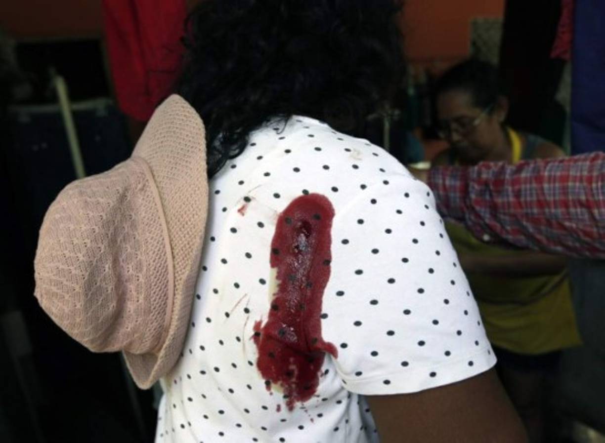 Mirna Tenorio, 56, resultó herida durante el ataque de los supuestos paramilitares a la marcha.