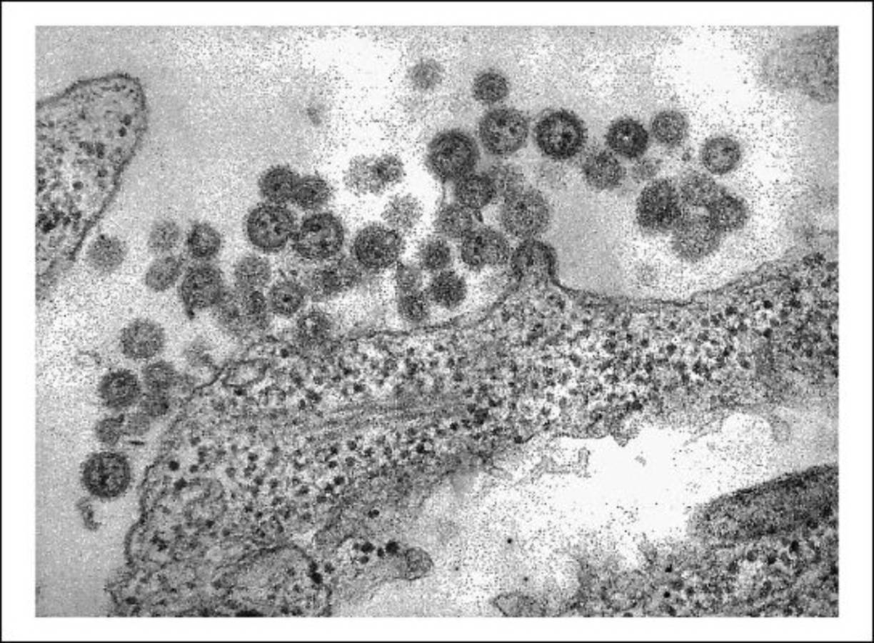 Virus Machupo - La cepa de este virus provoca una patología grave llamada fiebre hemorrágica boliviana o tifus negro. Los infectados padecen migrañas, dolores corporales agudos, fiebre alta y hemorragias. Fue identificado en 1959 y tiene una tasa de mortalidad de 5 a 30 por ciento.
