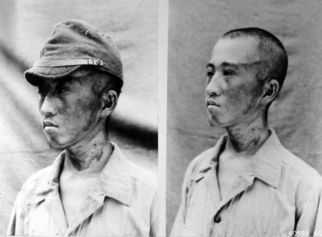 El riesgo de leucemia alcanzó su pico siete u ocho años después de la exposición a la radiación, mientras que los casos de cáncer comenzaron a aumentar 20 años después.