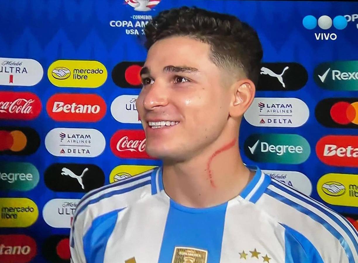 ¡Herida de guerra! Pero lo más curioso fue que Julián Álvarez mostró la marca que le dejó un rival canadiense en el cuello durante el encuentro. A la ‘Araña’ tuvieron que frenarla con faltas.