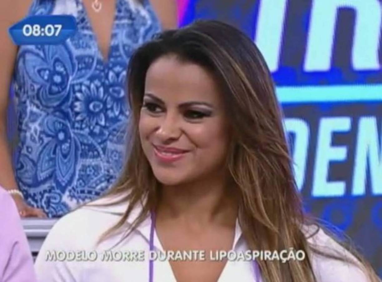 Pamela Baris se estaba sometiendo a la que era su tercera liposucción, pero no pudo salir del quirófano y falleció por una grave hemorragia.