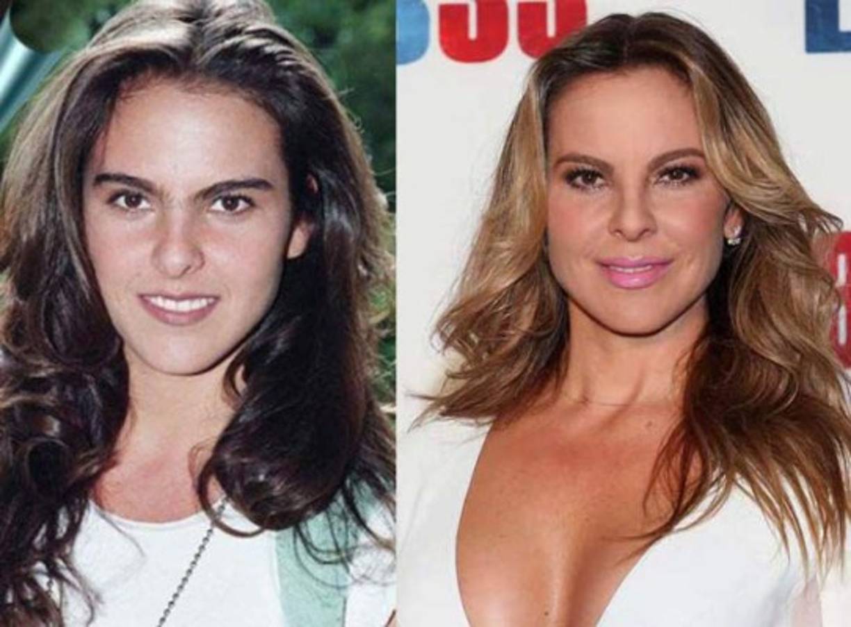 10. Kate del Castillo: La actriz comenzó desde muy joven en las telenovelas ahora es toda una empresaria y sus fans han sido testigos de su cambió físico a lo largo de su carrera pero ¿se ha hecho algún retoque o sólo ha mejorado con los años?