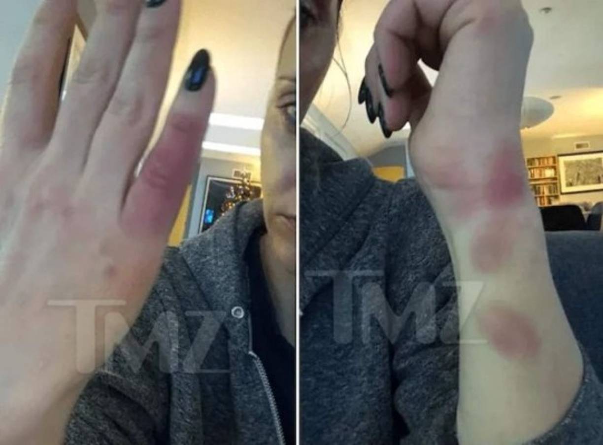 Un incidente en el que le dejaron moretones habría sido el detonante de su solicitud.