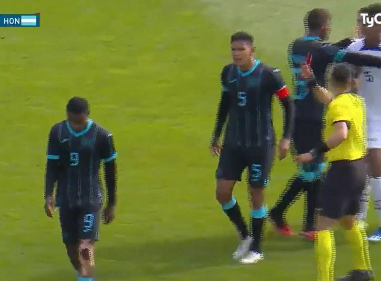 Daniel Carter se fue expulsado y el capitán Luis Vega se molestó por su agresión a jugador de EUA.