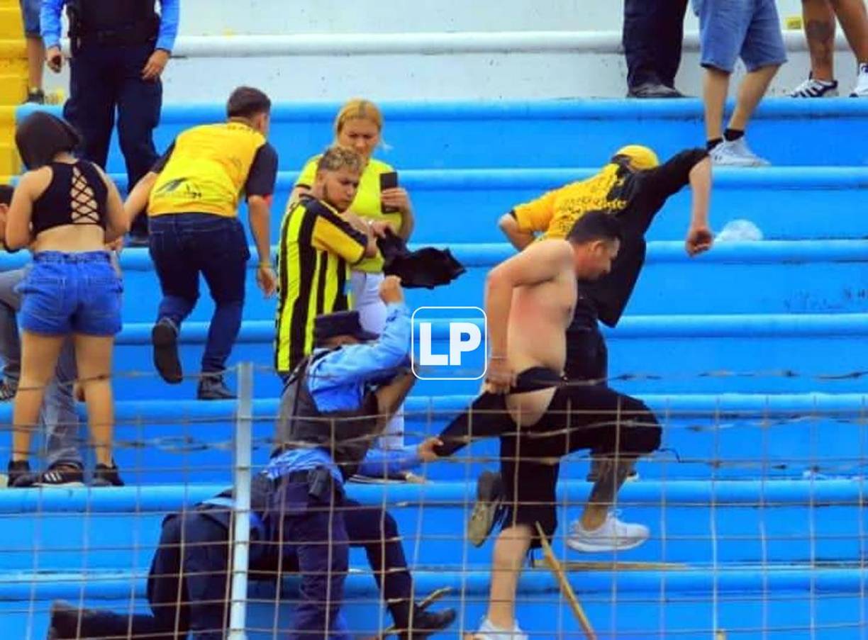 Así quedó este aficionado del Real España que trataba de protegerse de los policías.