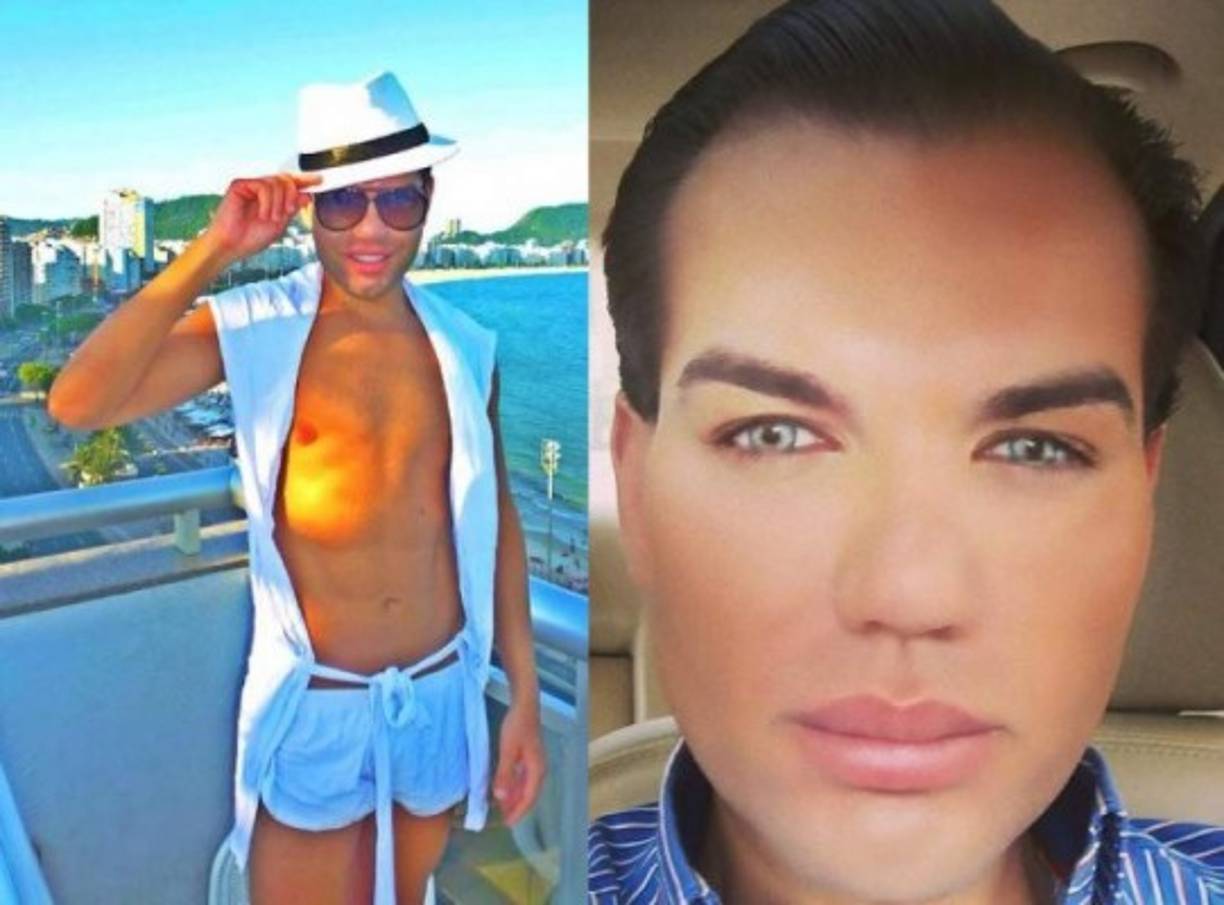 Rodrigo Alves, es el nuevo Ken humano, quien se ha realizado más de 50 cirugías plásticas en todo el cuerpo, originario de Brasil de 33 años ha invertido más de 350.000 euros en cambios estéticos.