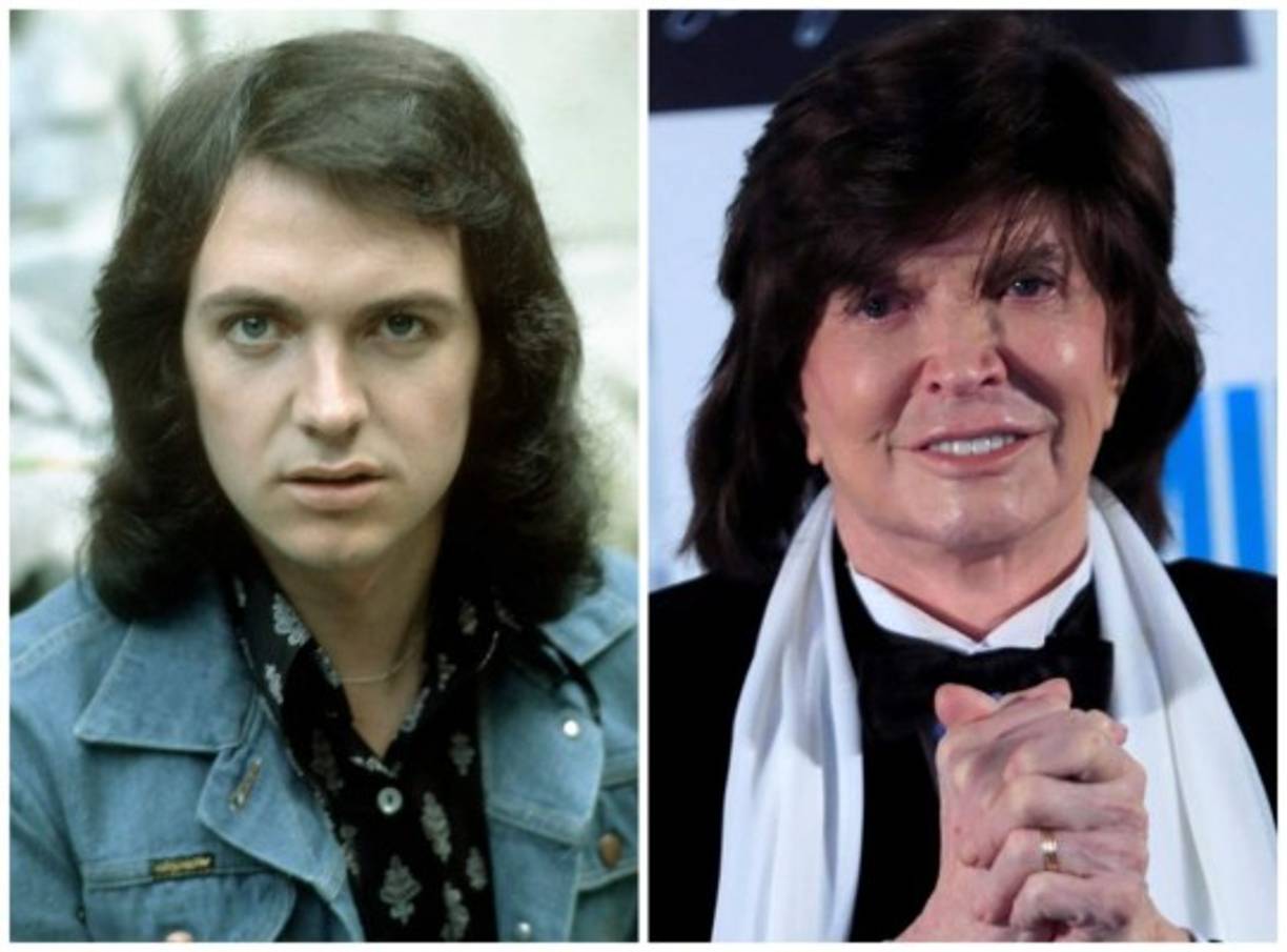 Tantas enfermedades dejaron al español en estado de salud frágil. A esto hay que agregar las cirugías que fueron transformando su cara y por poco le dieron otra apariencia, muy alejada de aquel romántico que seducía con su voz y mirada.<br/><br/>