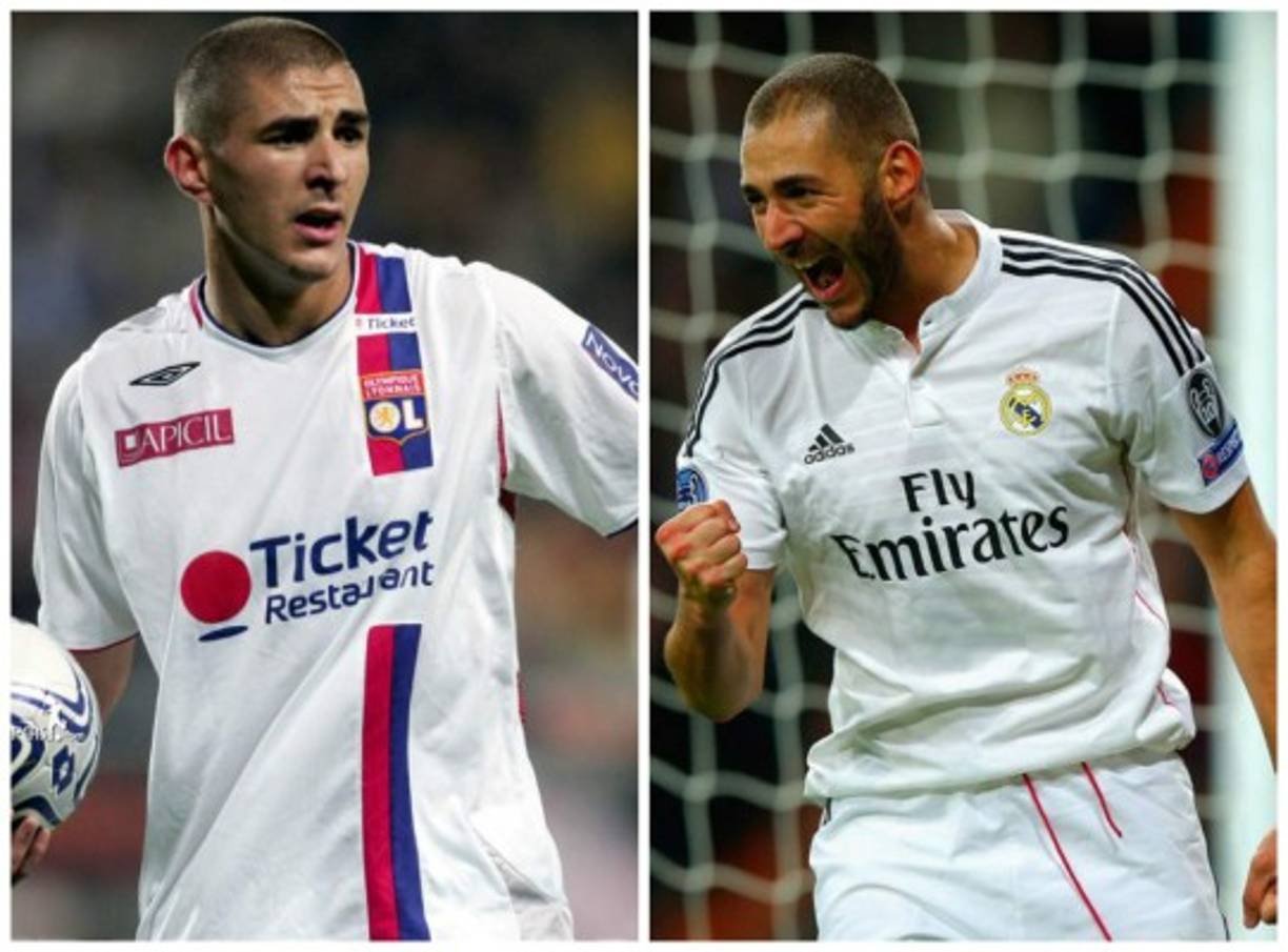 Karim Benzema.