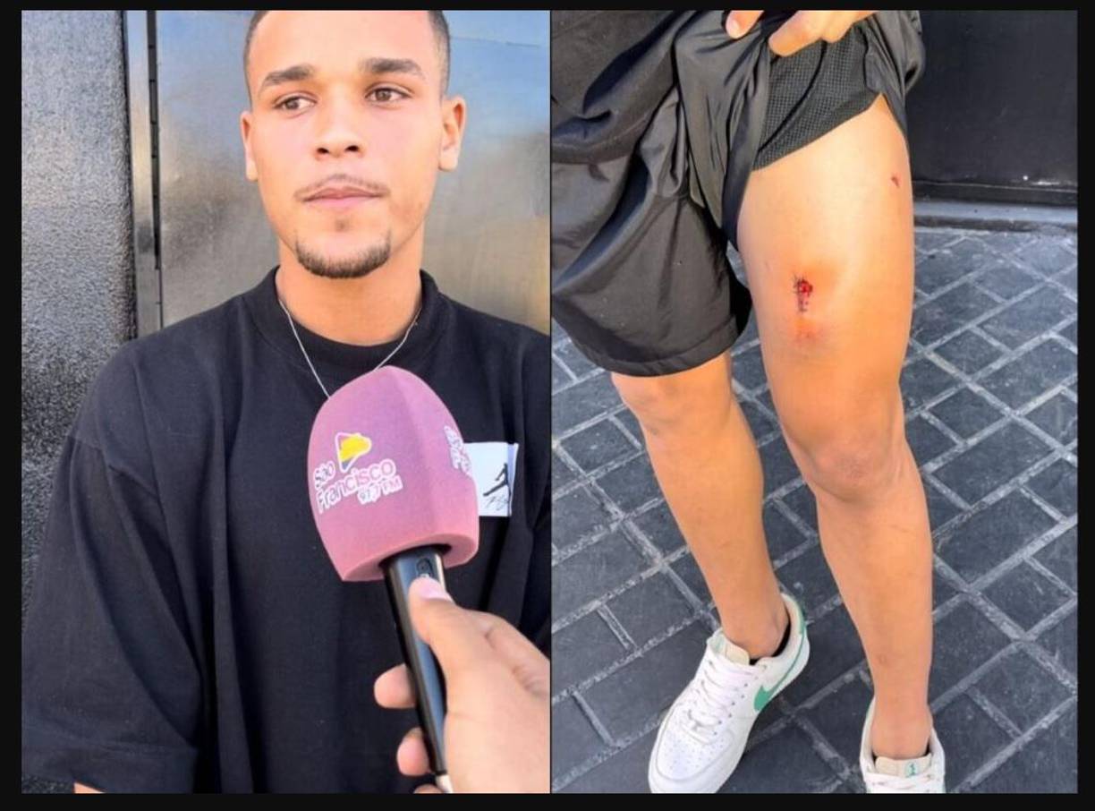 El portero Ramón Souza, del Grêmio Anápolis, alcanzado por una bala de goma disparada por un policía, se pronunció tras registrar una denuncia policial este jueves (11). 