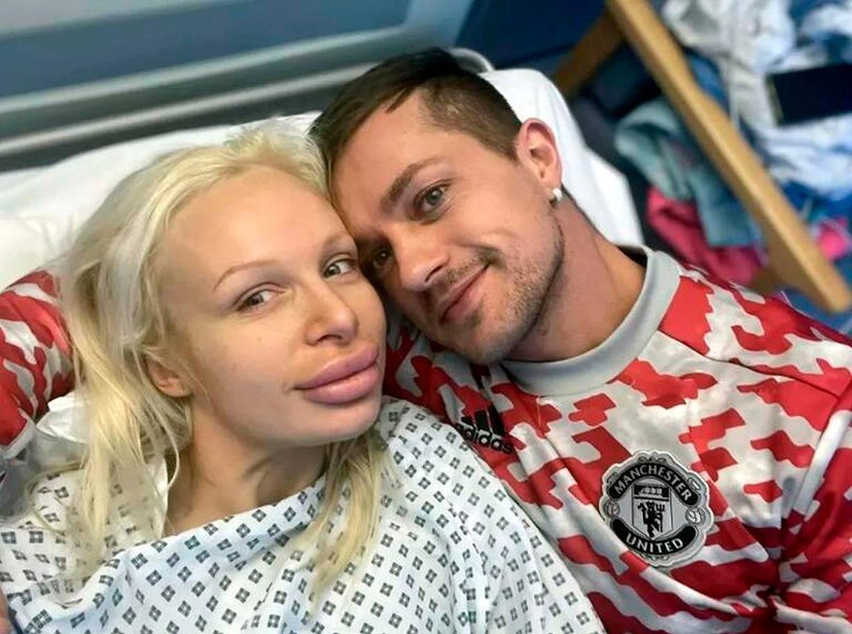 En cuanto a su relación con Sophie Anderson, también fue compleja. La también actriz porno casi perdió la vida cuando uno de sus implantes estalló, meses atrás, lo que le provocó una septicemia. Aunque trascendieron rumores de su muerte, luego los amigos de la actriz los desmintieron.