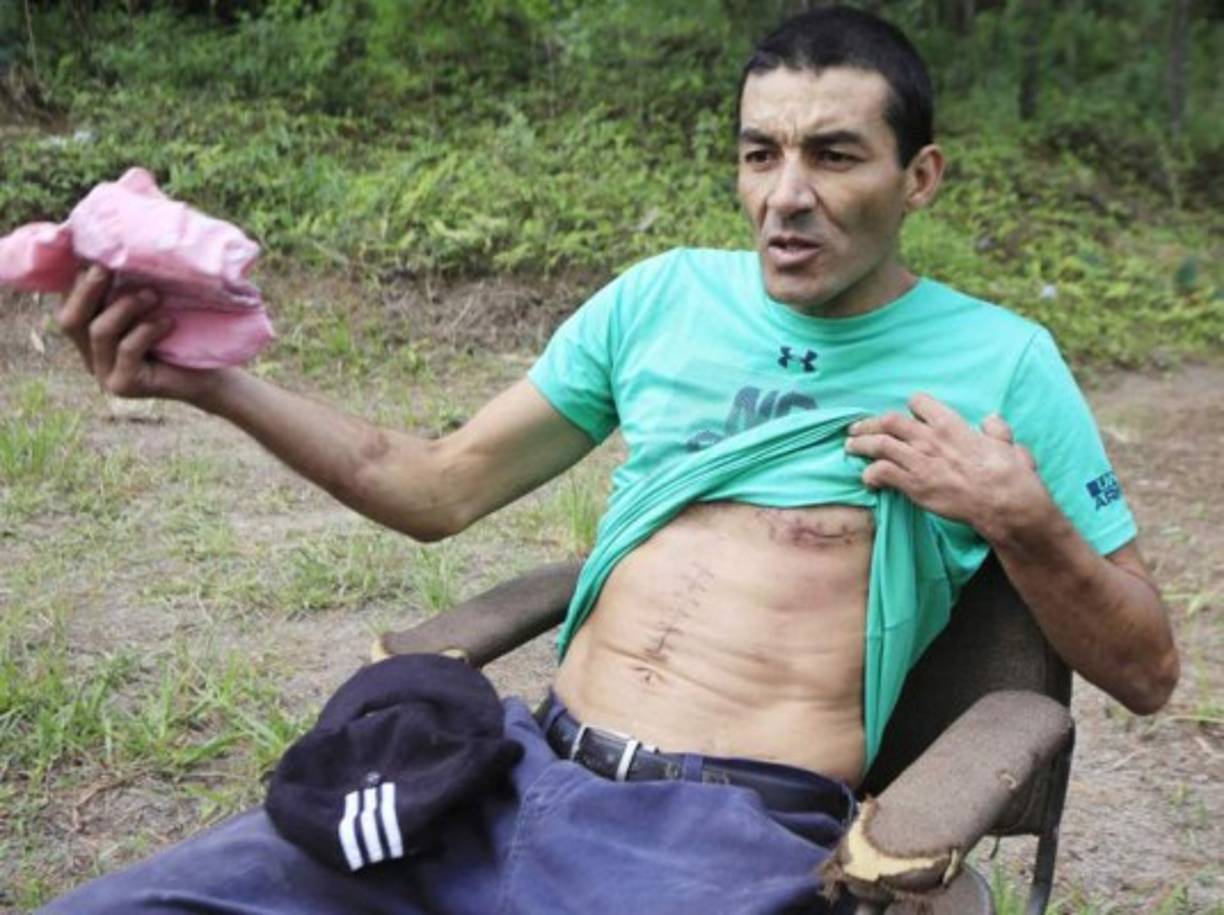 Óscar Lagos: El exjugador hondureño lo perdió todo por culpa de las drogas. 'En lo único que pensaba era en drogarme, lo hice durante 25 años y comencé a hacerlo desde los 11', le reveló a Diario Diez hace unos años.