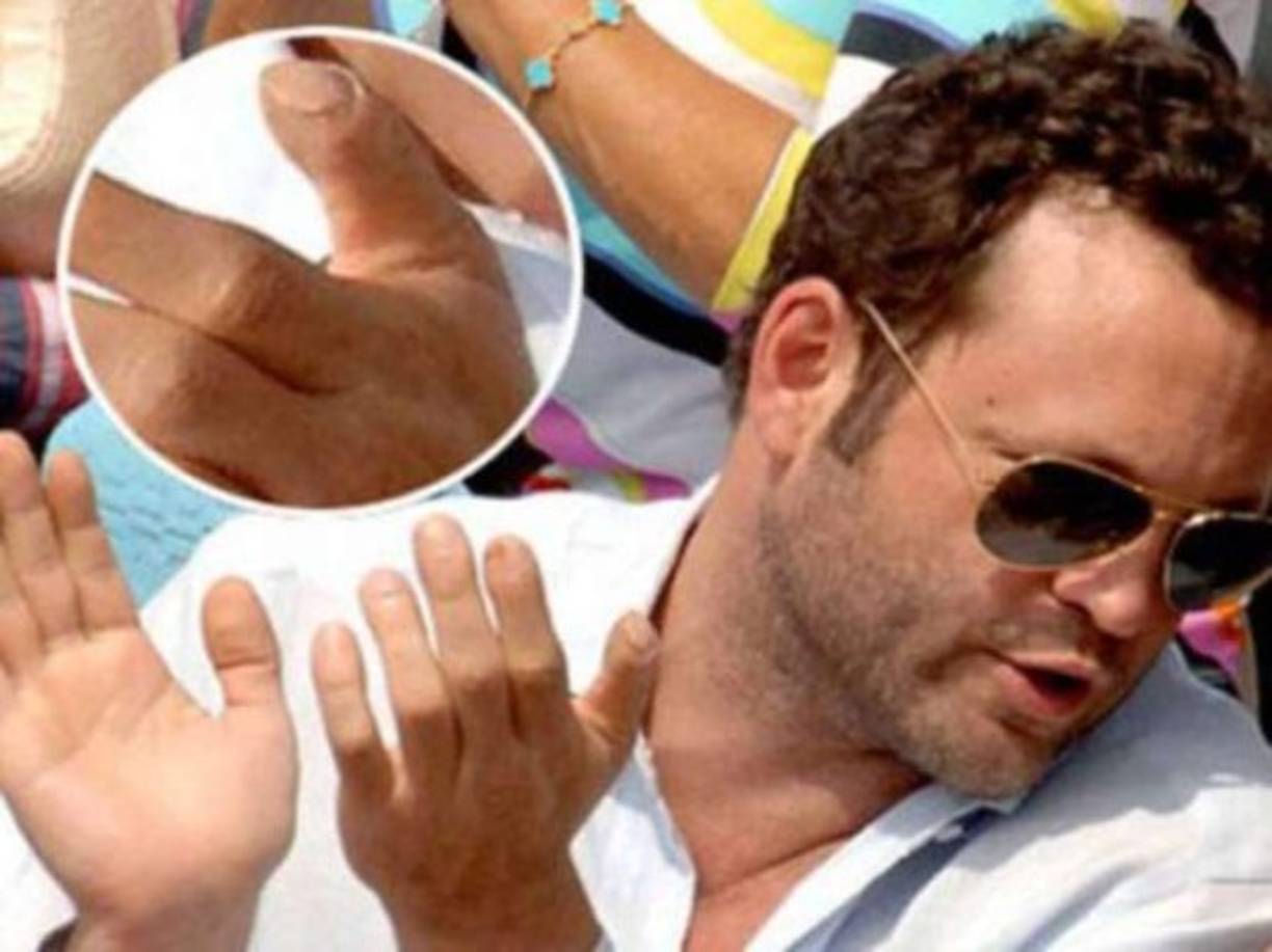 El actor estadounidense Vince Vaughn perdió la punta de su dedo pulgar en un accidente automovilístico cuando tenía 17 años de edad. <br/>