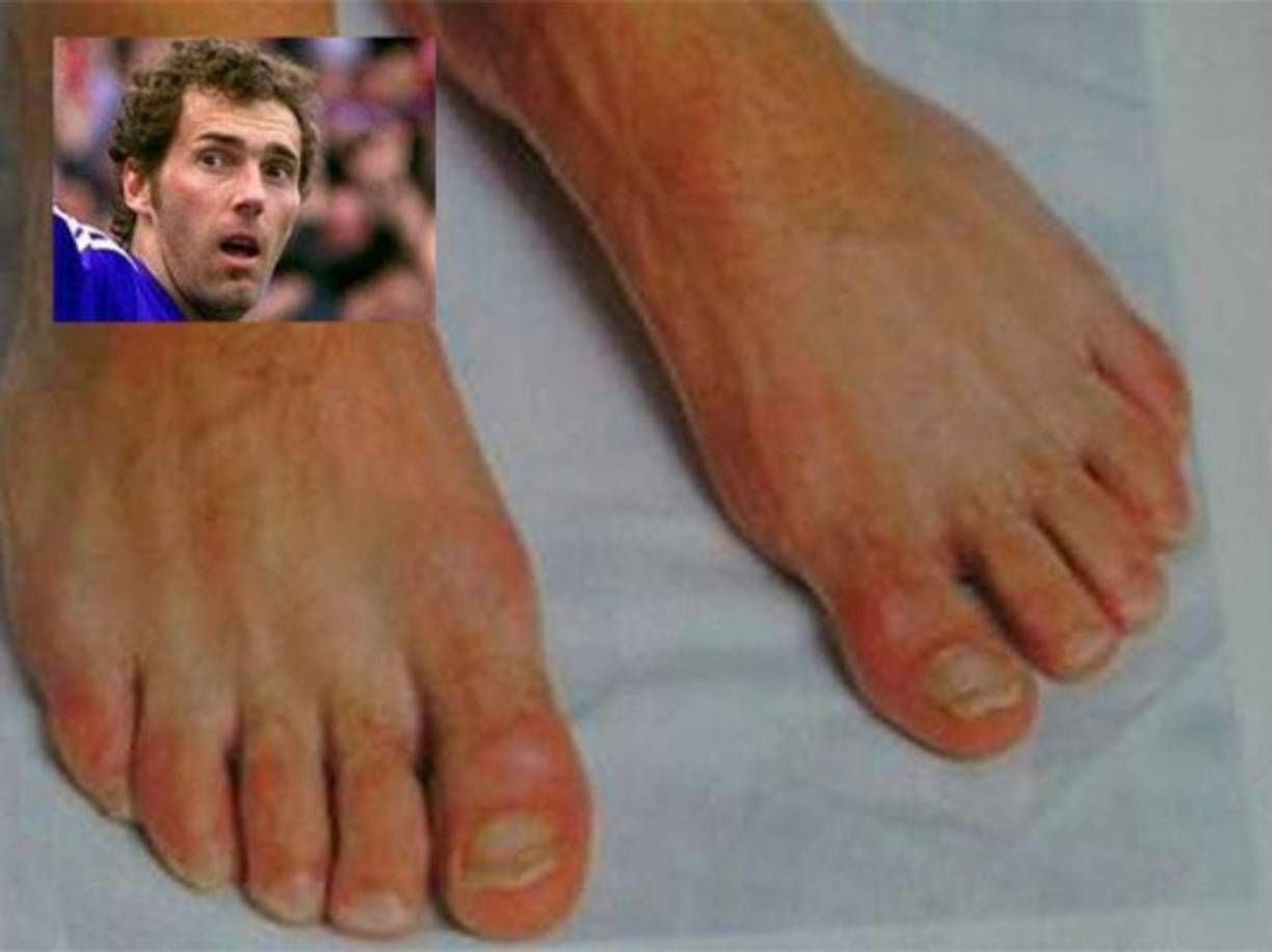 Laurent Blanc, ex jugador francés campeón de un mundial y entrenador de su selección.