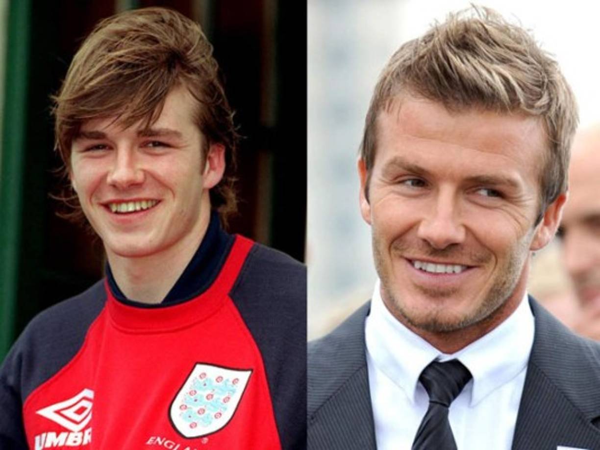 David Beckham: Aunque en ocasiones lo ha negado, medios ingleses han informado que en su momento el exjugador inglés se sometió a varias cirugías estéticas.