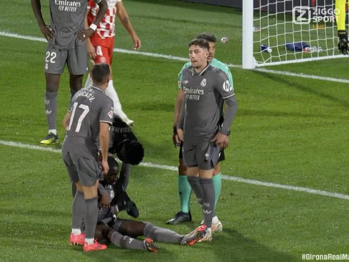 Las malas noticias llegaron en el segundo tiempo. Ferland Mendy, lateral izquierdo del Real Madrid, aumentó la plaga de lesiones musculares que sufre el equipo de Carlo Ancelotti al ser sustituido en Montilivi ante el Girona por un problema en el cuádriceps de la pierna izquierda a diez minutos del final.