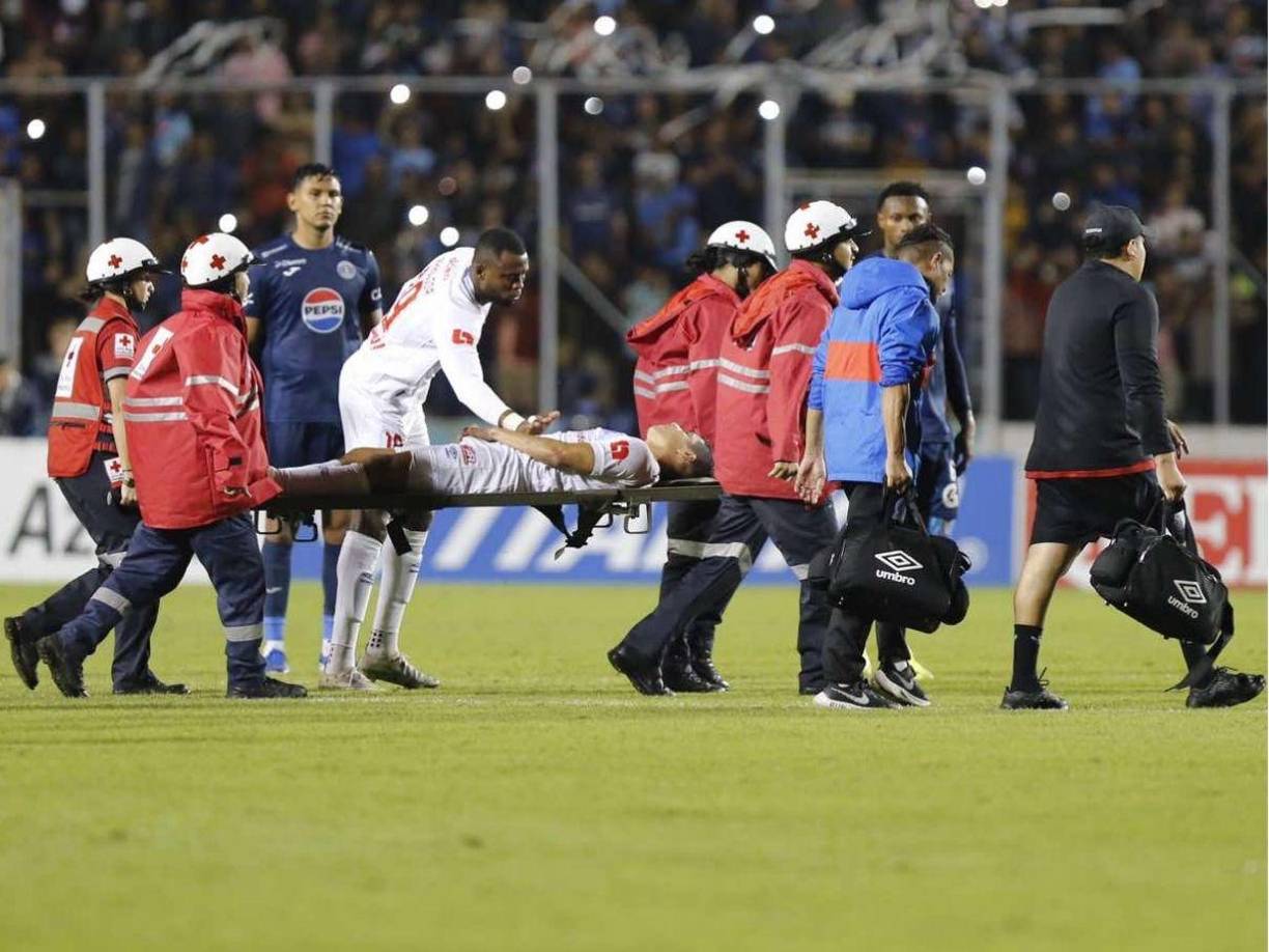 Fue trasladado de inmediato a una clínica privada en Tegucigalpa y se reportó que sufrió una luxación de la clavícula izquierda grado 3 y una leve contusión, le harán exámenes. Su tiempo de baja es de 3 a 4 semanas.