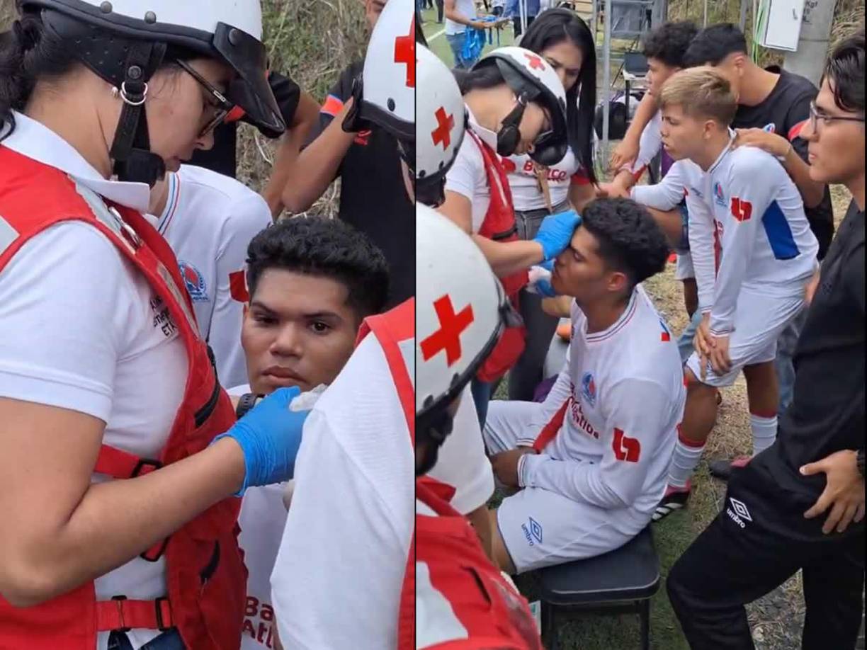 Este jugador del Olimpia sufrió una herida en su rostro tras la batalla campal.