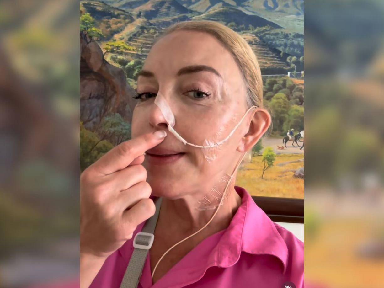 “Esta tripita va a estar ahí 24 horas, está conectada a este juguete, el cual mide exactamente cómo funciona mi esófago; tengo que apuntar qué comí”, indicó la artista.