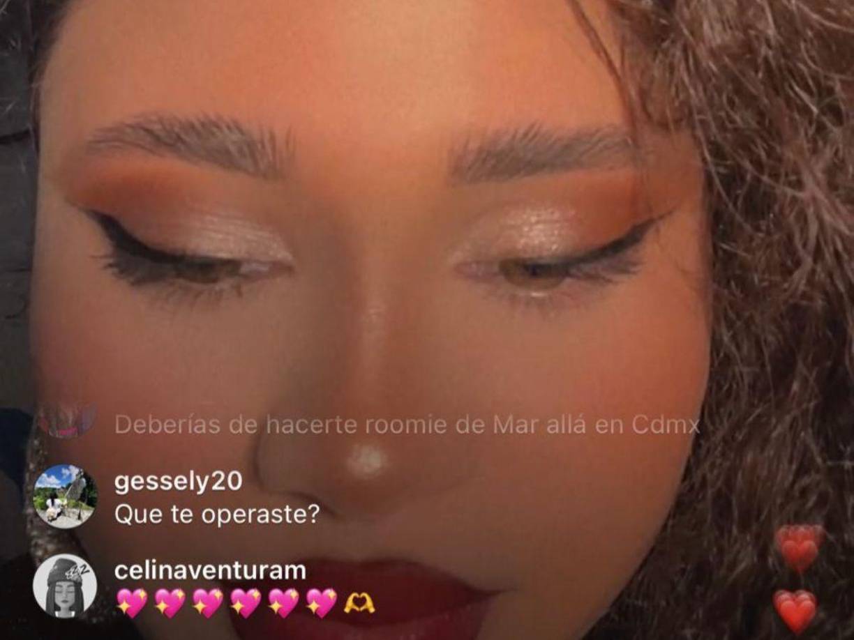 Los rumores de que Cesia se realizó una cirugía han aumentado entre sus seguidores quienes en sus transmisiones le consultan si sometió a alguna operación. 