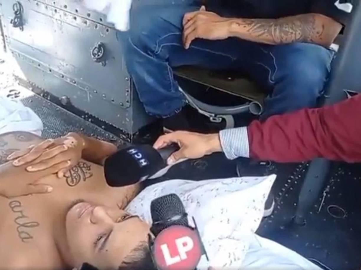 También tiene una quemadura de tercer grado que le dañó el estómago, además tiene otra en el glúteo y necesita un injerto