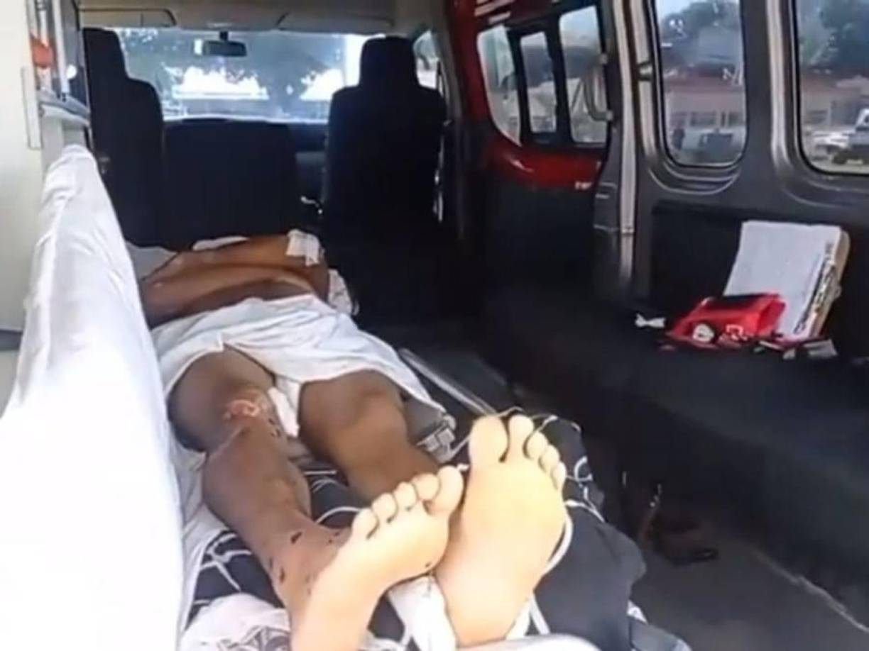 Ya había sido intervenido quirúrgicamente en la parte posterior del cuello donde le pusieron tornillos.