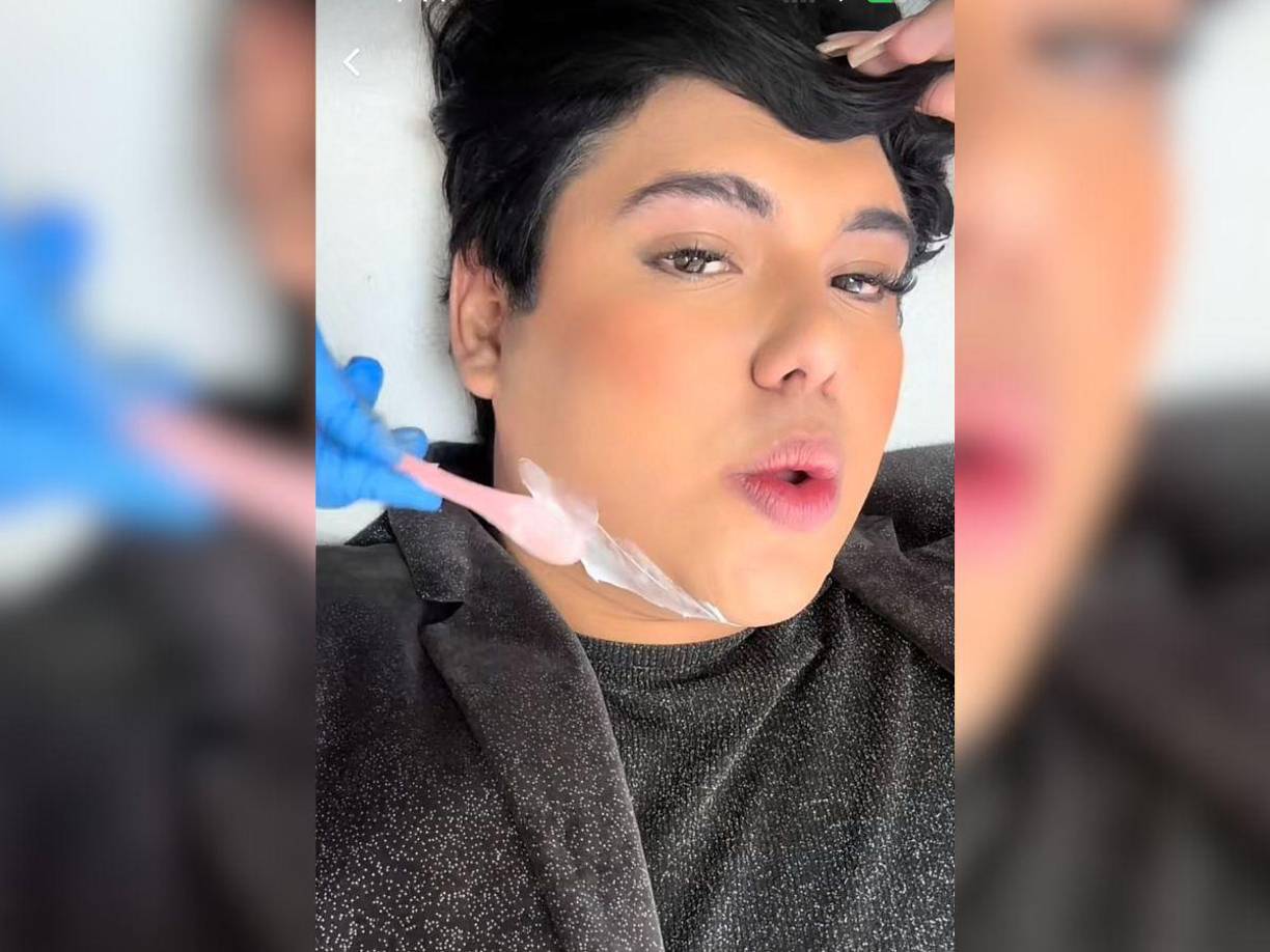 Recientemente, Antonio Sandrez sorprendió a sus seguidores al revelar que se sometió a un nuevo procedimiento estético. 