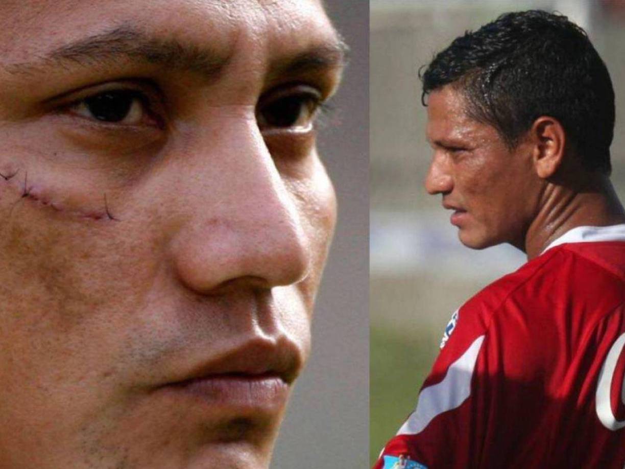 También, fue pieza fundamental en títulos logrados con Marathón bajo el mando de Keosseián.