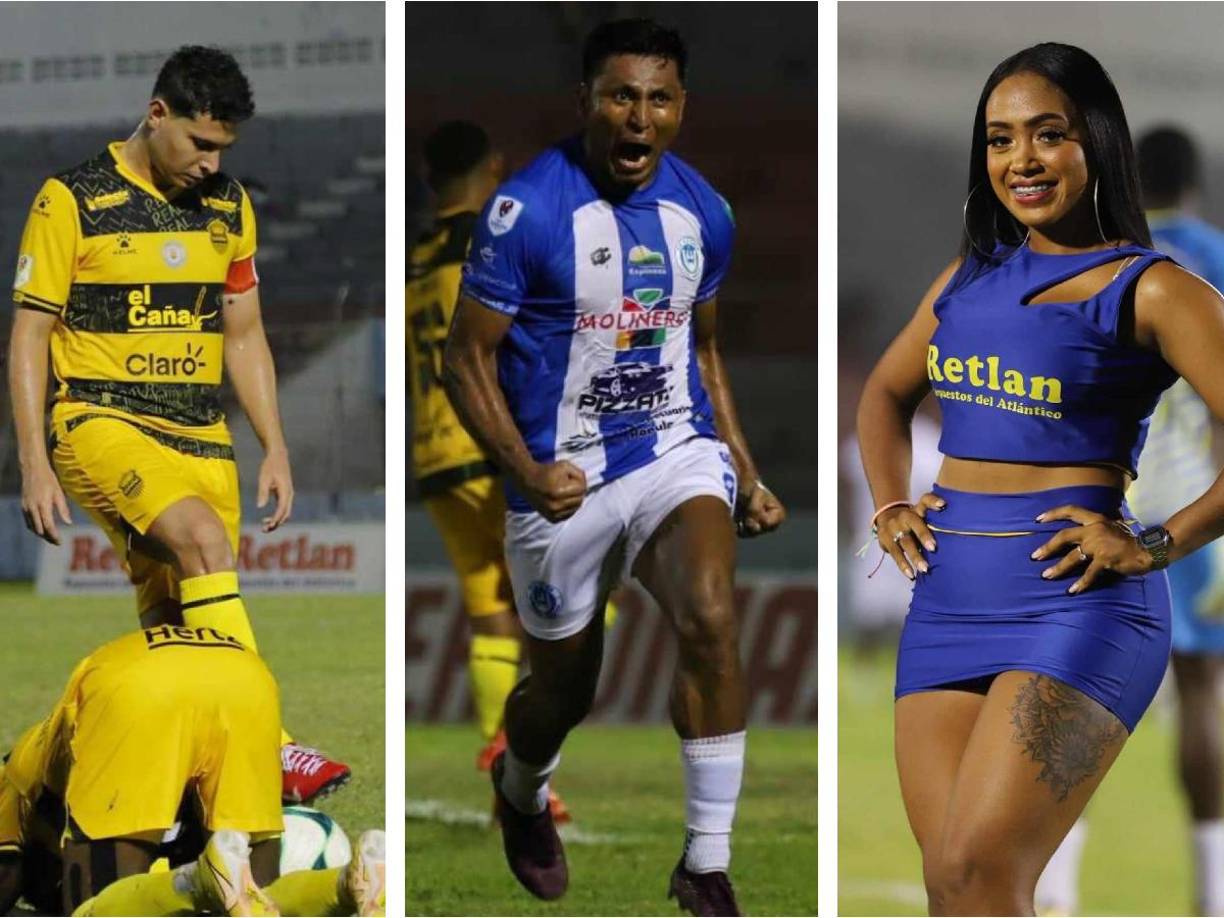 El partido entre Victoria y Real España dejó un festín de goles en La Ceiba. Aquí te mostramos las mejores imágenes de la derrota 4-3 de la Jaiba Brava a los Aurinegros. 
