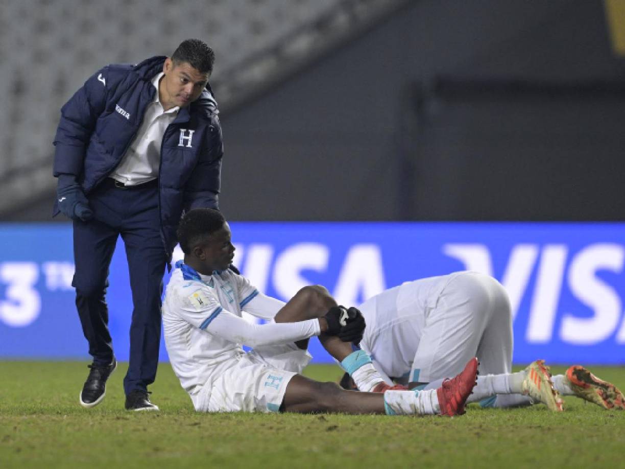 La selección Sub-20 de Honduras quedó eliminada del Mundial en Argentina luego de caer por 3-1 ante Francia. Así reaccionaron tras la derrota.