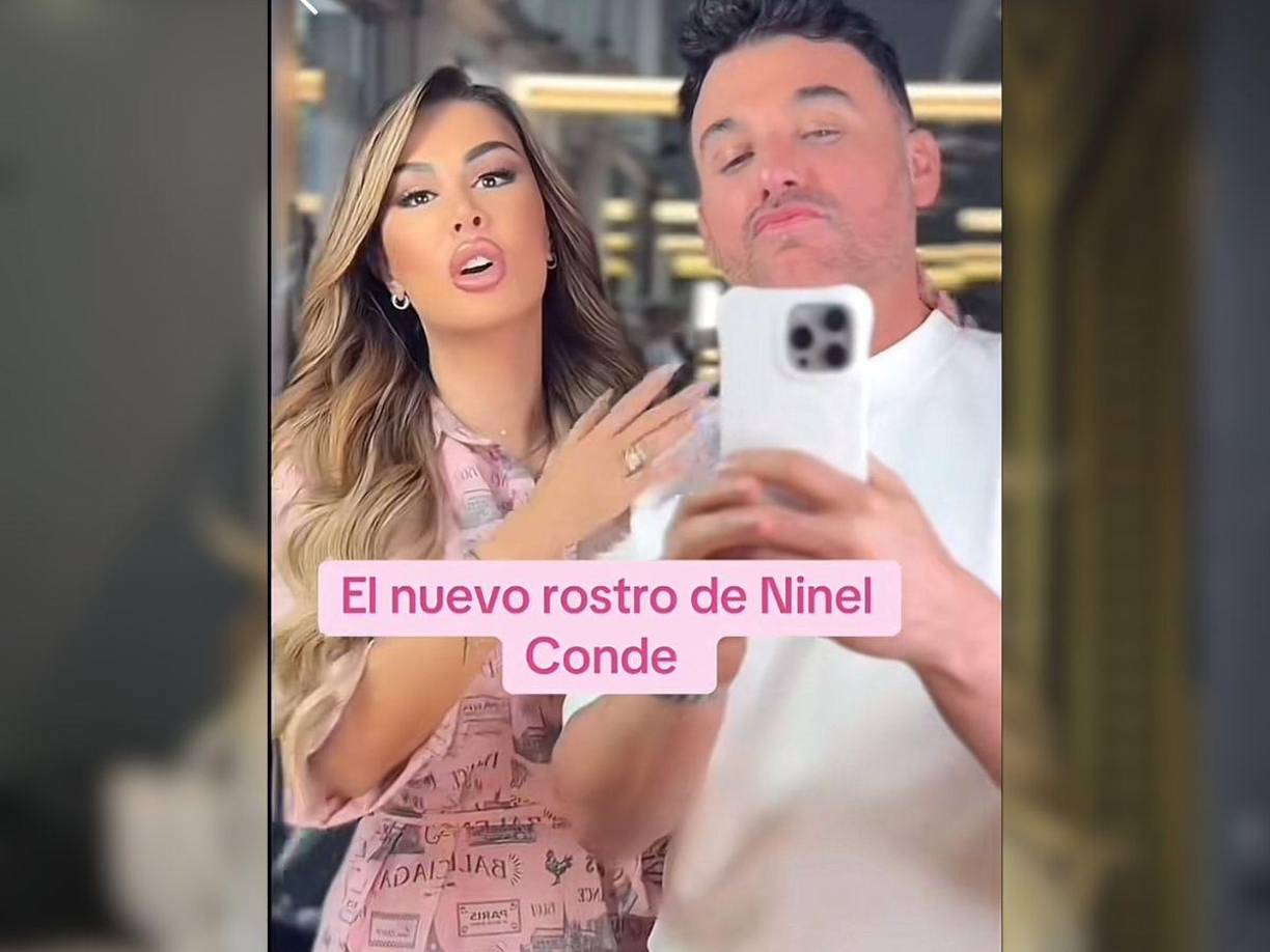 Si bien Ninel Conde no ha dado detalles sobre su nuevo rostro, el programa ‘Chisme no like’ aseguró que, hace tres meses, la famosa viajó a Turquía para quitarse los biopolímeros del rostro y se puso un implante en los labios.