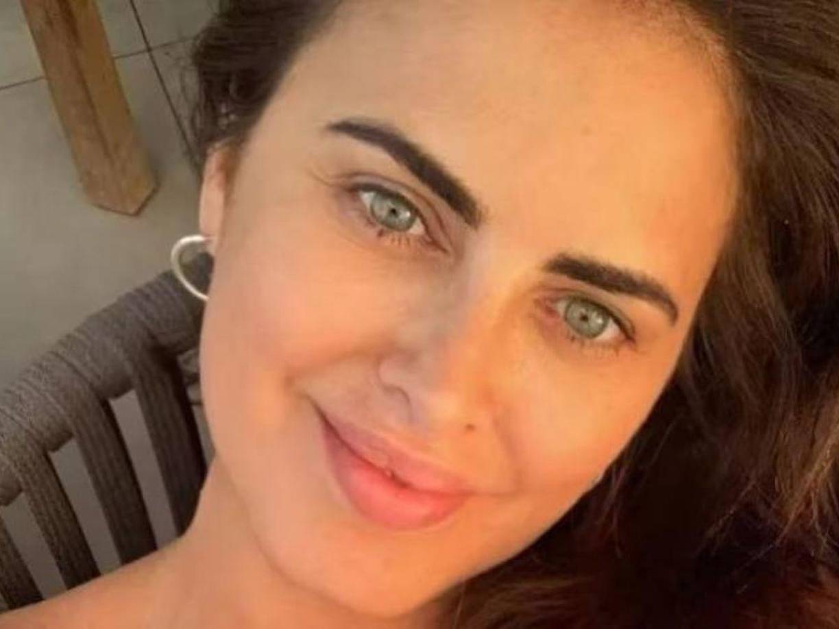 Pero los conflictos de salud no eran un asunto nuevo, la también modelo tuvo que luchar por su vida luego de que, en 2011, se practicara una cirugía estética en los glúteos a manos del doctor Anibal Lotocki, donde se le aplicaron metacrilato y otras sustancias no identificadas que mermaron su situación y le desarrollaron los problemas médicos antes mencionados.