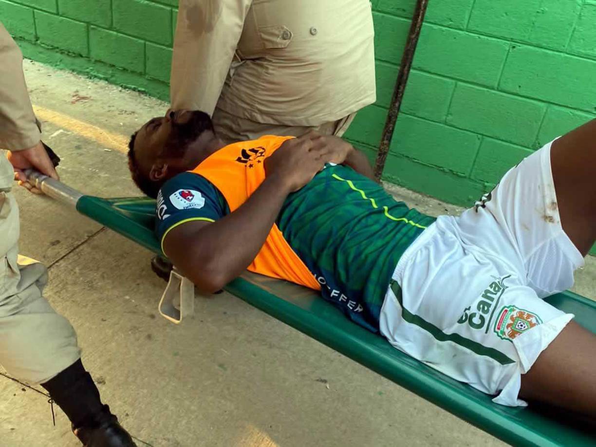 Las alarmas se encienden en el Marathón tras la lesión de su delantero goleador Clayvin Zúniga, quien tuvo que ser reemplazado en el minuto 30 del primer tiempo del partido Olimpia por la ida de las semifinales del Torneo Clausura 2023.