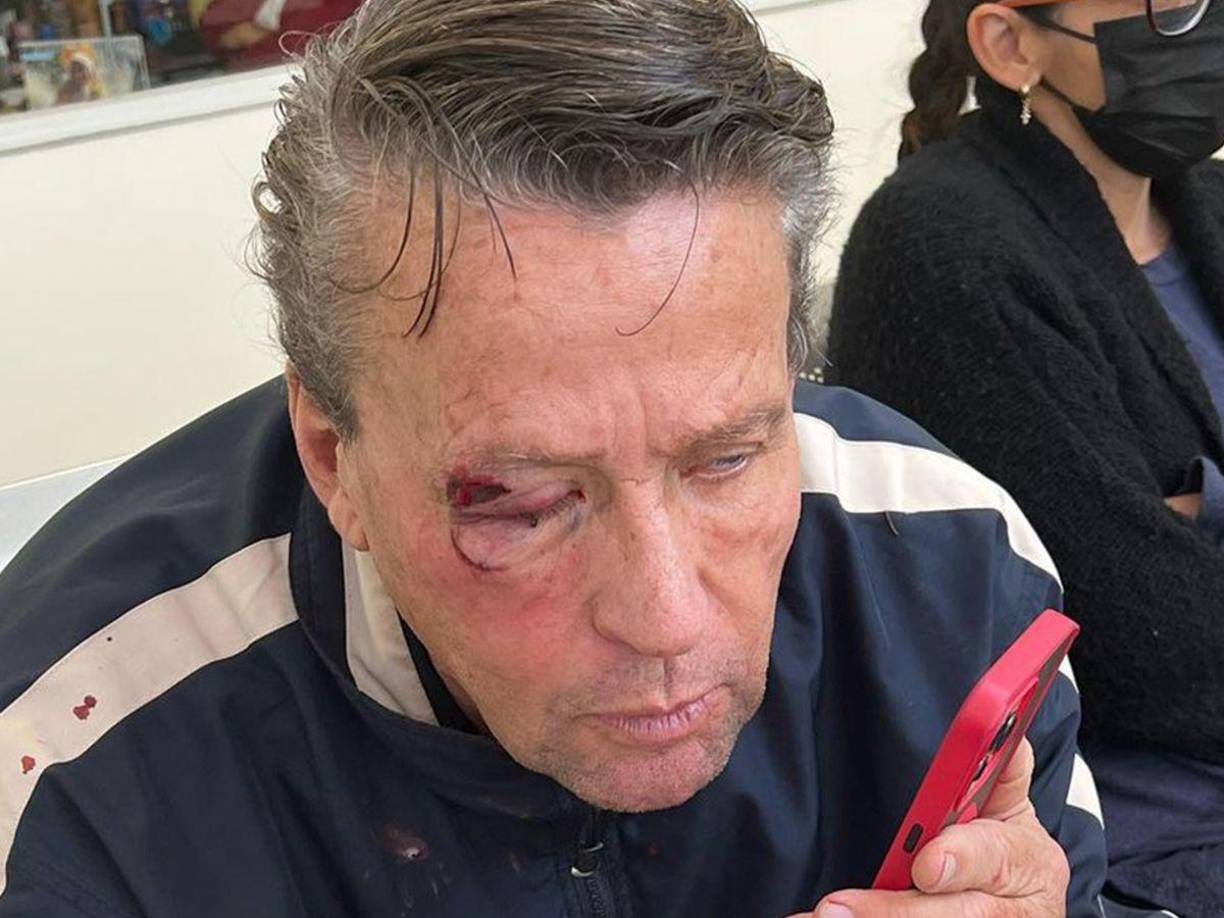 En septiembre, Adame recibió una fuerte golpiza fuera de su casa.