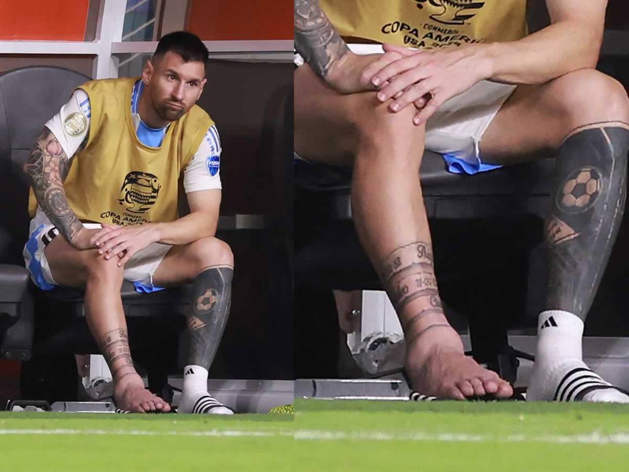 IMPACTANTE: La imagen del tobillo derecho de Messi poco después de salir del campo.
