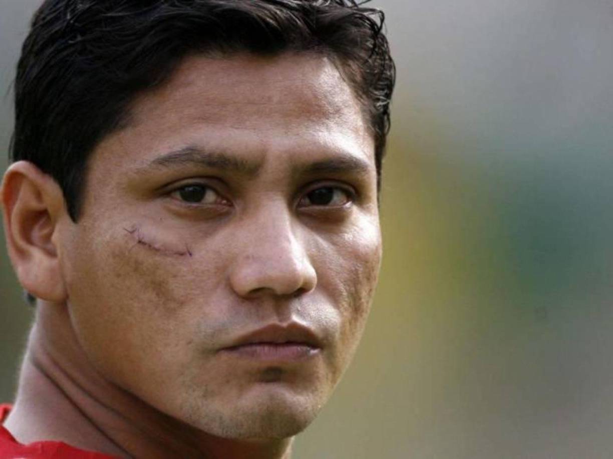 Óscar “Pescado” Bonilla, exfutbolista de La Liga Nacional, también fue agredido en Támara.