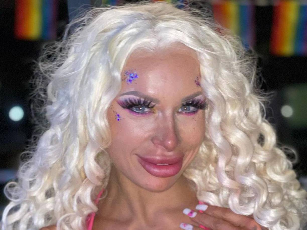 En marzo del 2022, Sophie estuvo ingresada grave en el hospital debido a una sepsis después de que uno de sus implantes mamarios se infectara y explotara. 