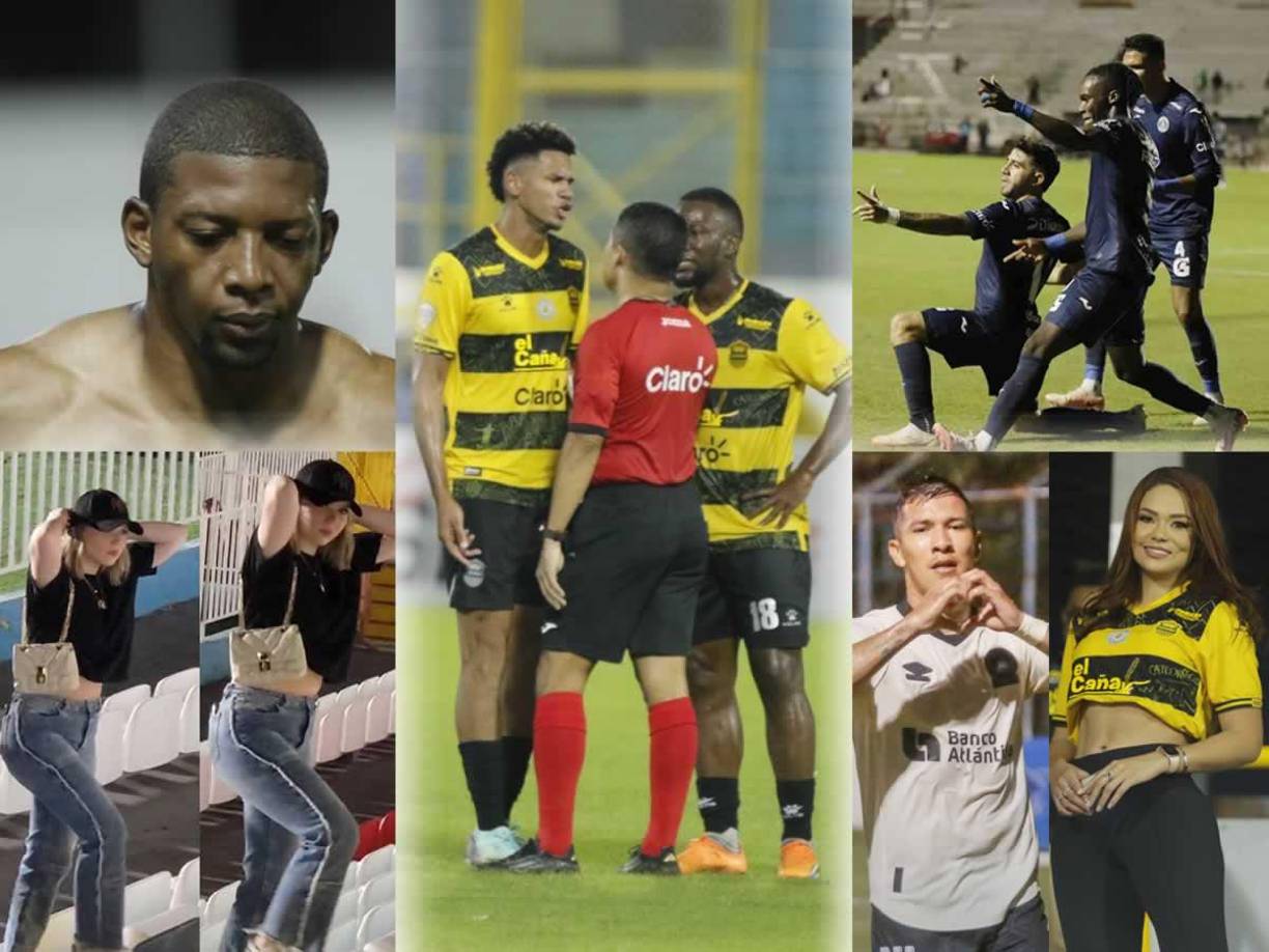 Las imágenes que dejó la disputa de la última jornada (18) del Torneo Apertura 2024 de la Liga Nacional de Honduras.