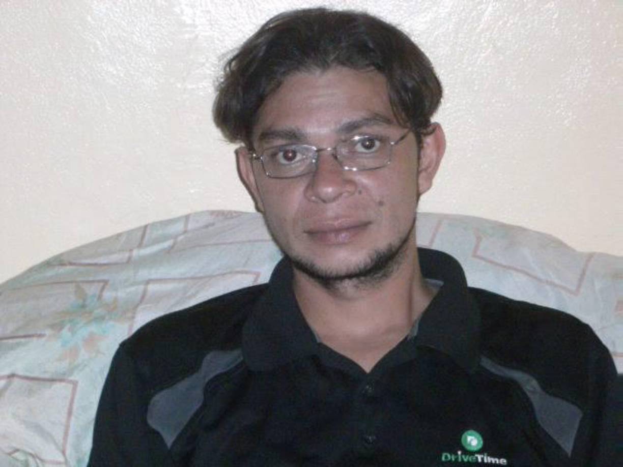 Al momento de hacer el reconocimiento, el cuerpo de Milton presentaba señales de quemaduras en varias partes del cuerpo.