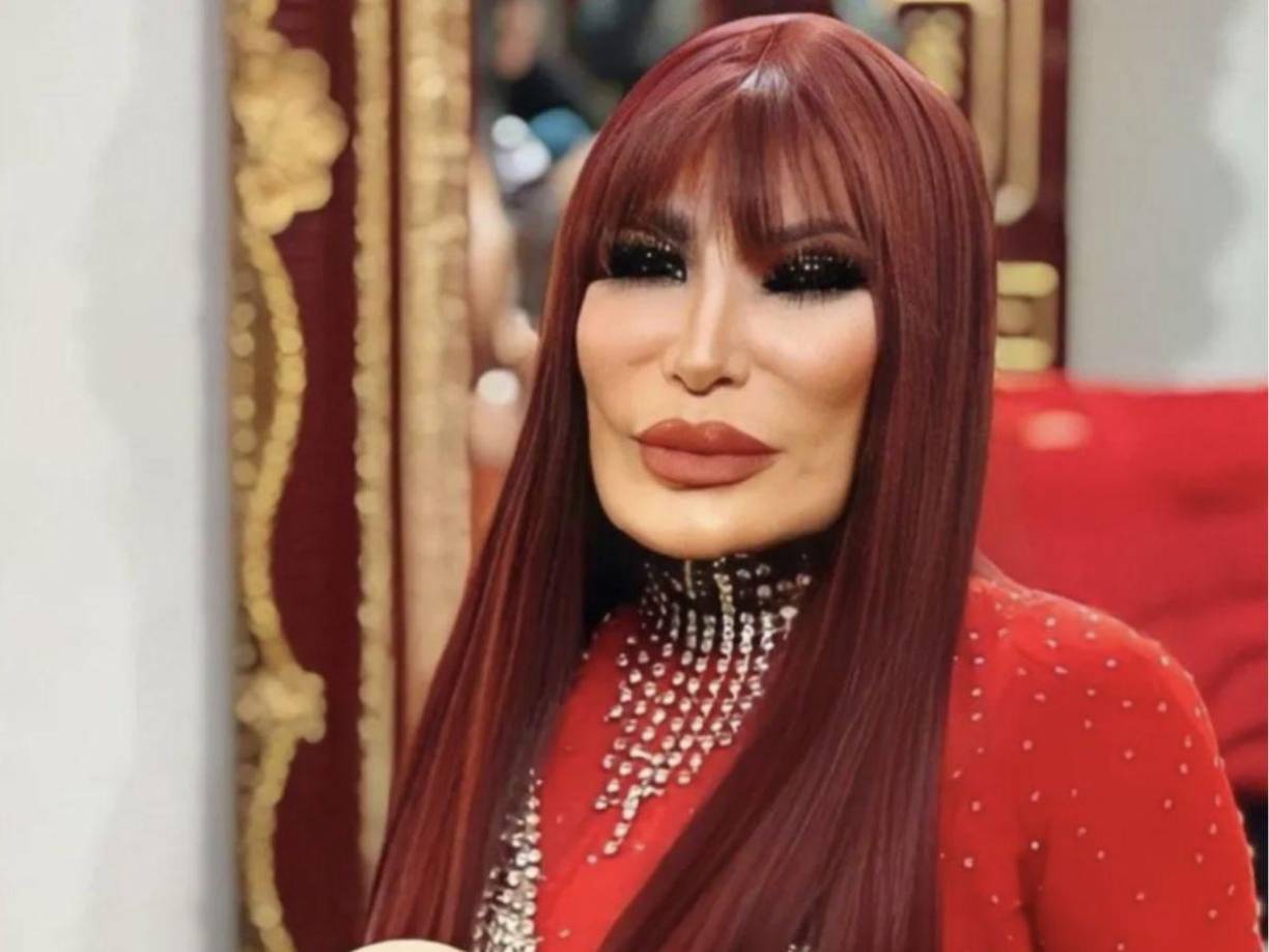 “Vicente no vio que venía mi marido y me abraza y me besa. Viene aquel y se agarran”, relató Lyn May divertida, quien aclaró la verdadera naturaleza de su relación con Vicente Fernández: “Pues no anduve... anduvimos así, acostones, ¿no?”, reveló la vedette.