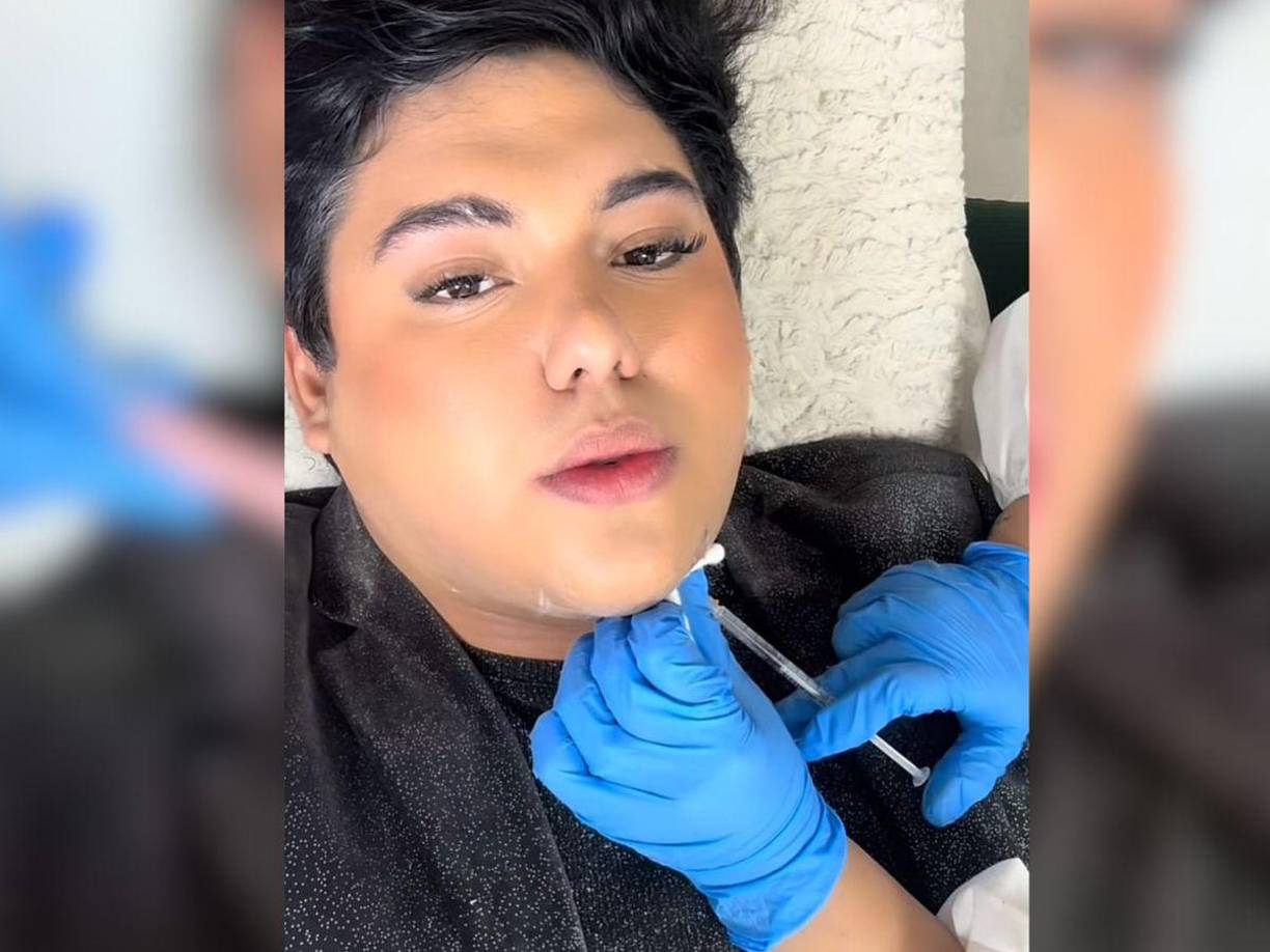 Se trata de una lipopada sin intervención quirúrgica. 