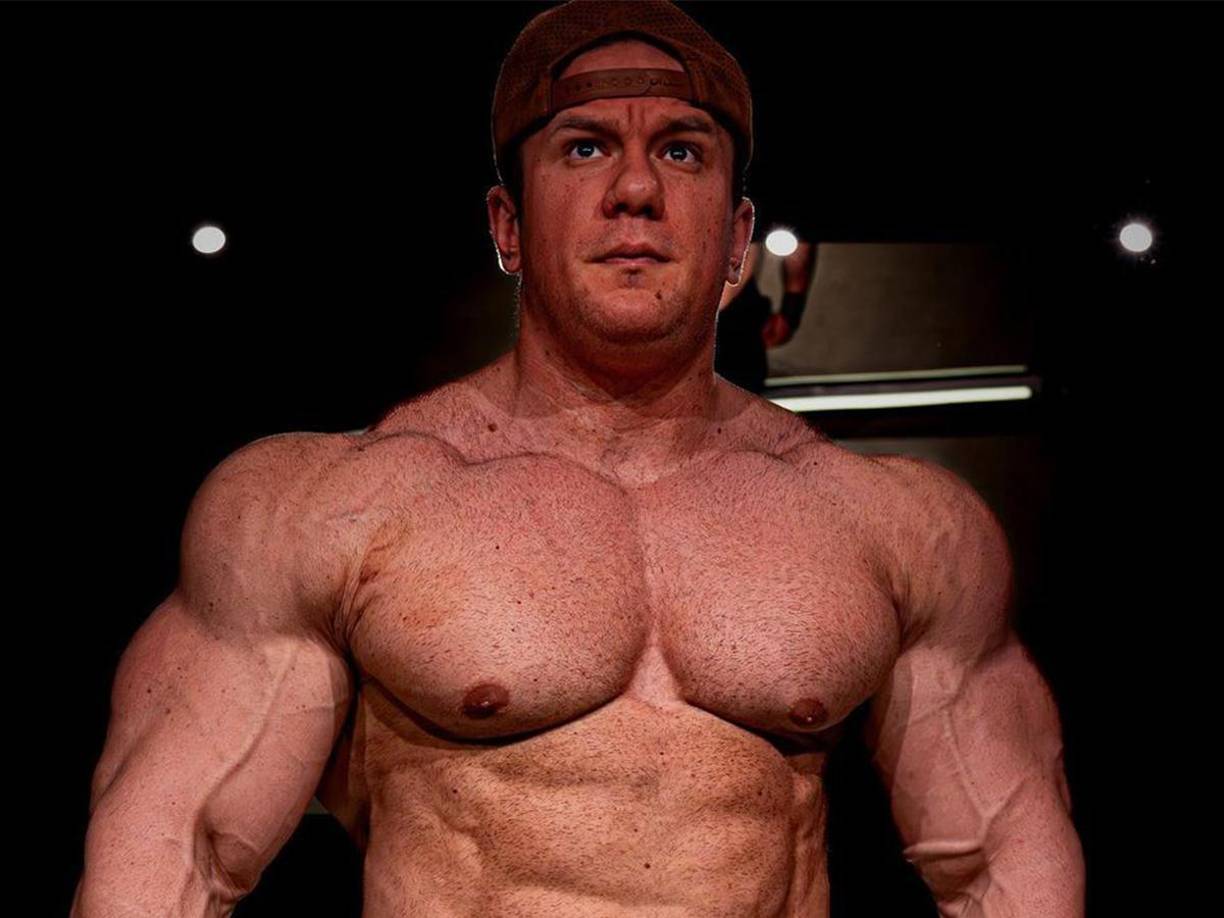 El fisicoculturista acabó perdiendo la vida durante la intervención, que se complicó mucho más de lo esperado. 