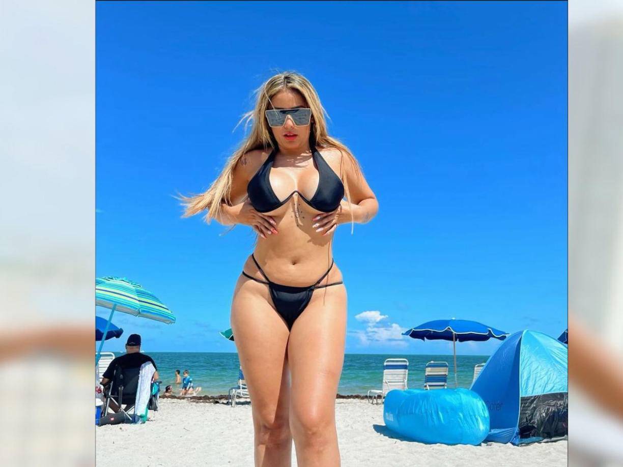 Aunque en el pasado muchas personas la criticaban por sus cirugías plásticas, Elsa nunca ocultó que se sometió a varios procedimientos estéticos. 