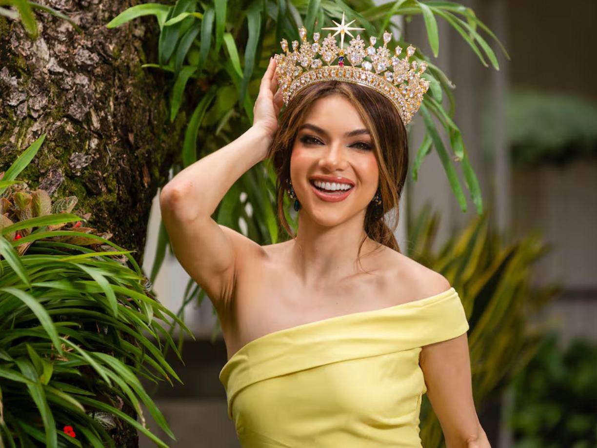 “Es [una enfermedad] progresiva pero estamos tratando de mejorar. Por eso mi doctora me dijo ‘Mara, por qué no usas peluca, para que el poco pelo que estamos recuperando no se te dañe”.