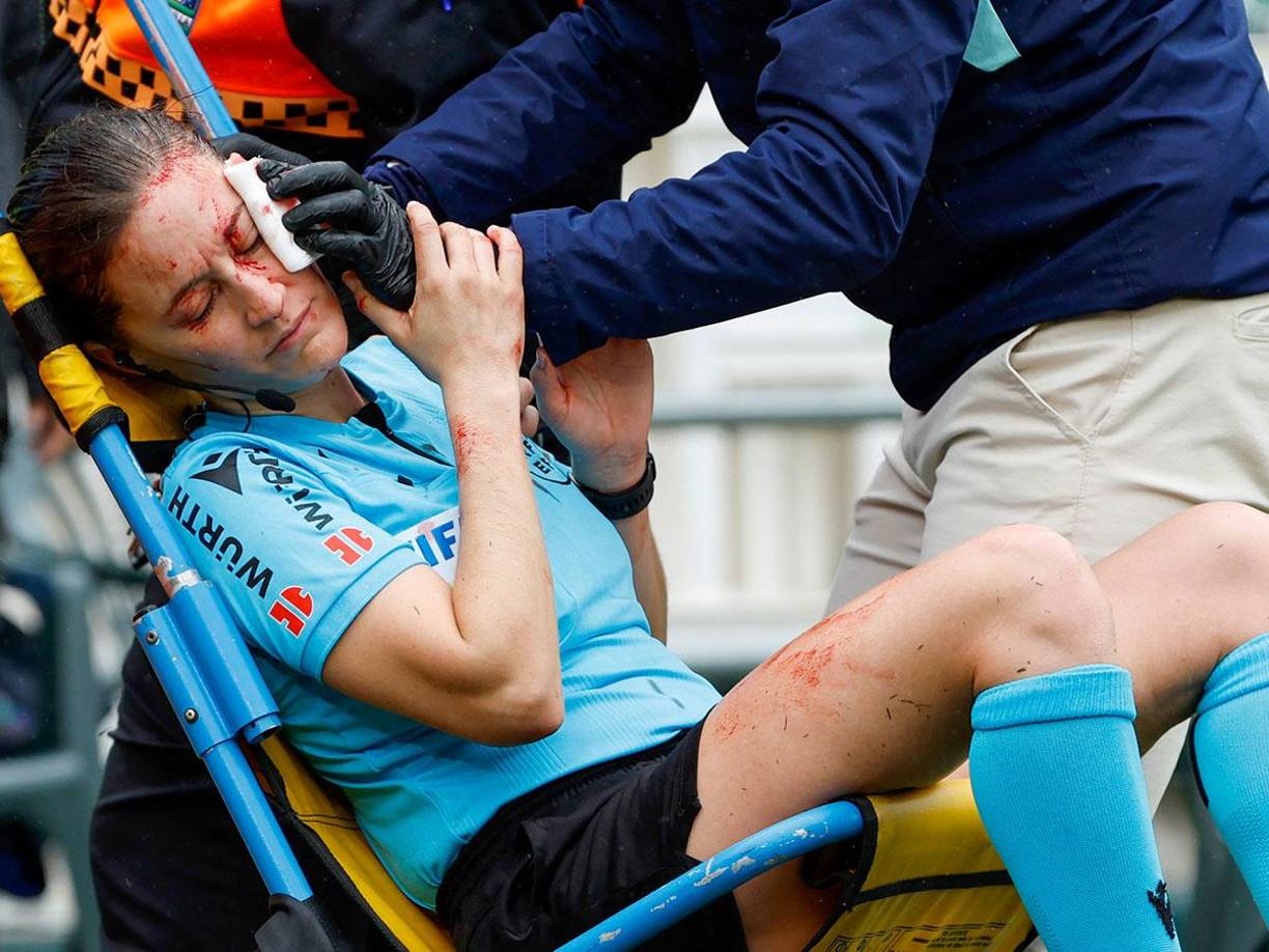 La árbitra se hizo una herida tras el golpe, de la que fue atendida sobre el césped justo después de que el argentino Chimy Ávila adelantara a los béticos en el marcador a los trece minutos de juego tras un pase del brasileño Willian José.