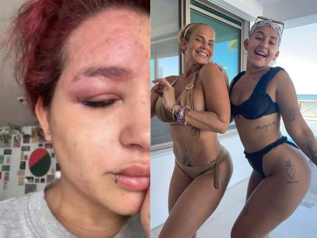 Romina Marcos ha causado preocupación tras revelar que está atravesando por un importante problema de salud.