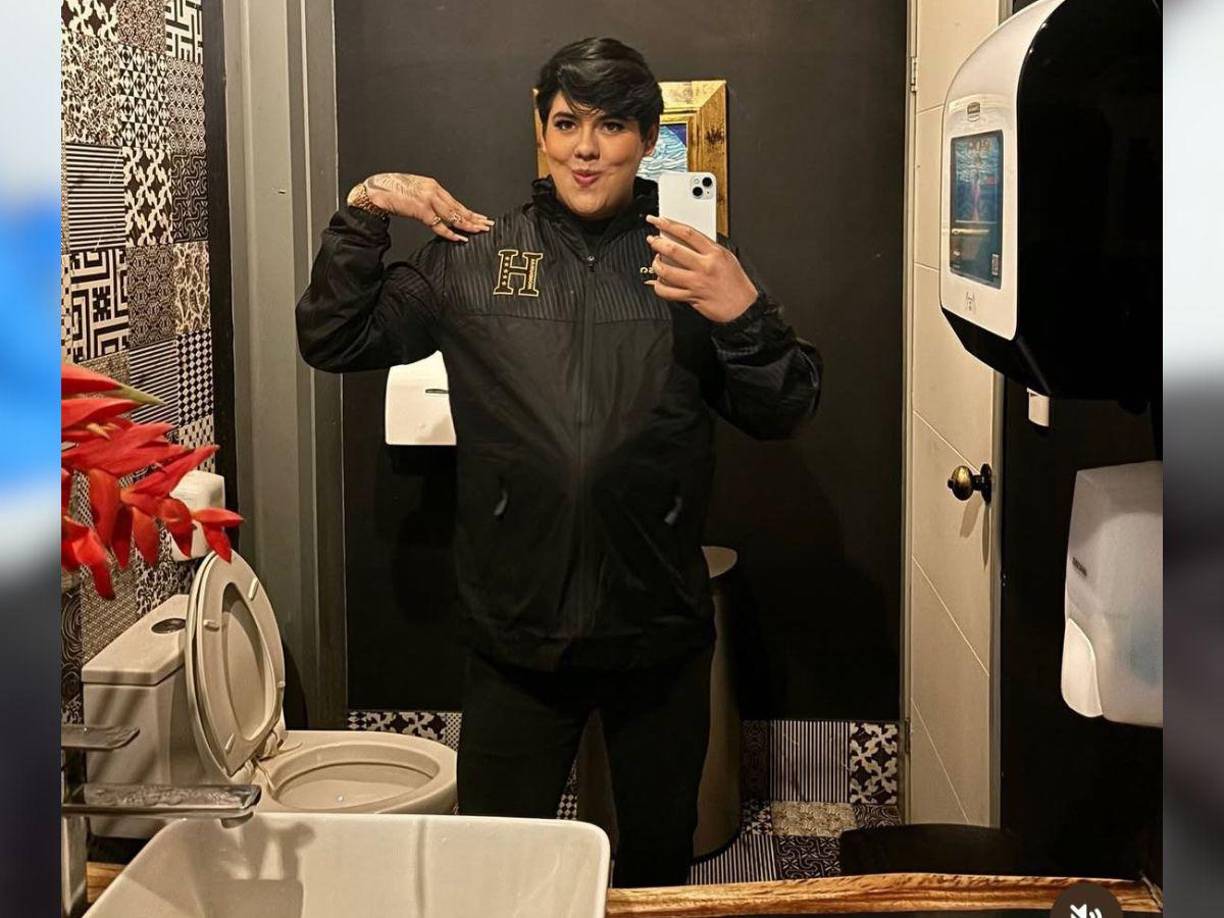 Antonio Sandrez explicó que los resultados de su procedimiento se verán en los próximos días. 