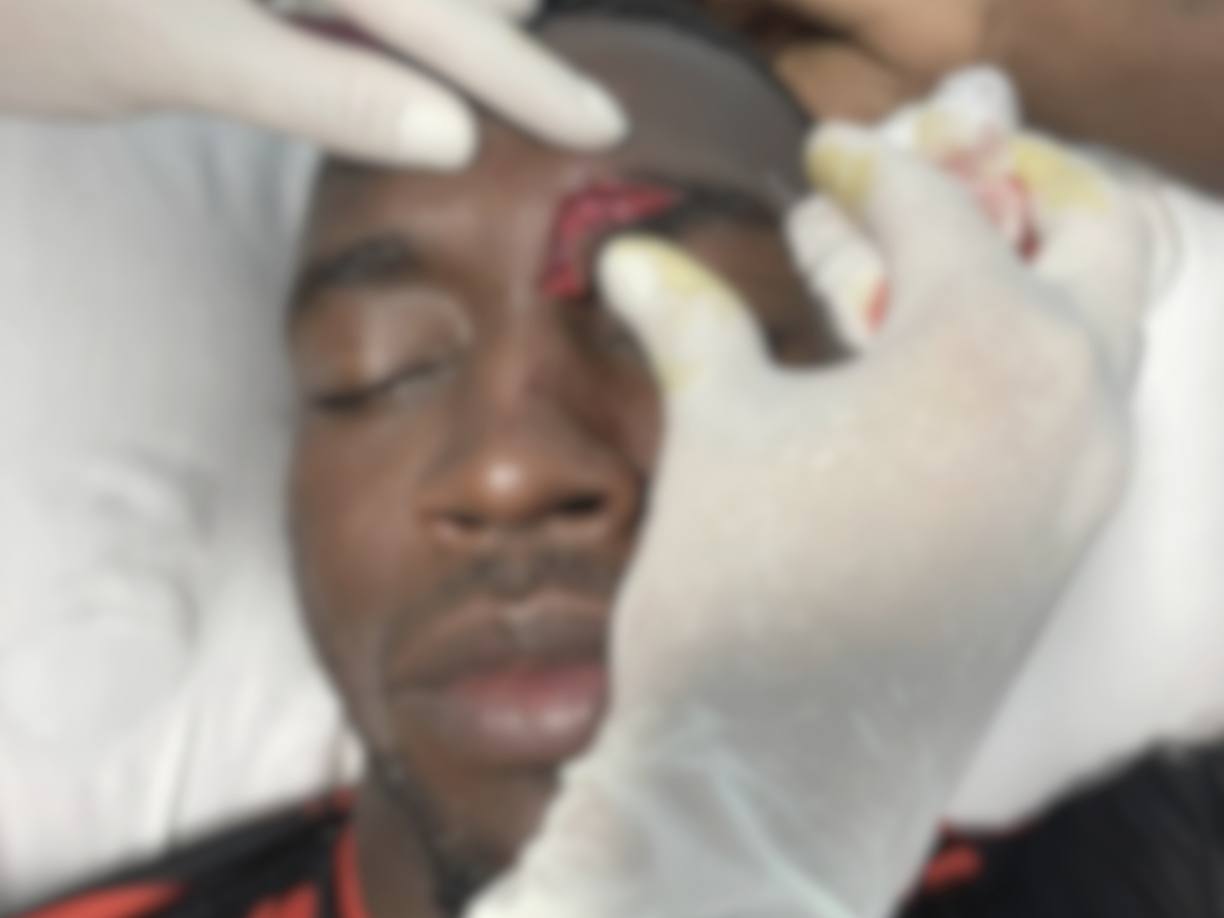 La herida que sufrió el volante colombiano del Independiente de Siguatepeque. 