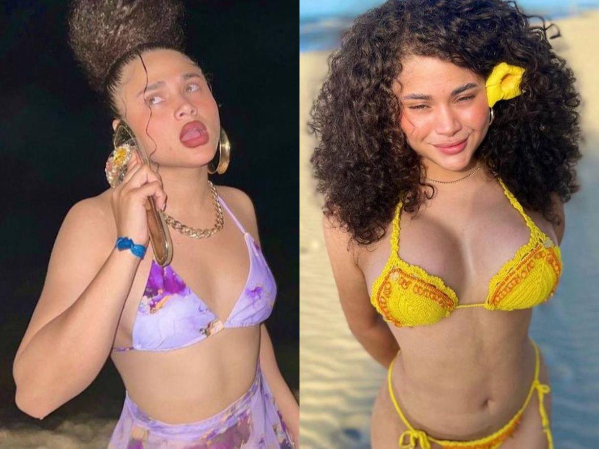 La leona de Honduras impactó a todos al revelar su nueva figura tras una cirugía estética. 