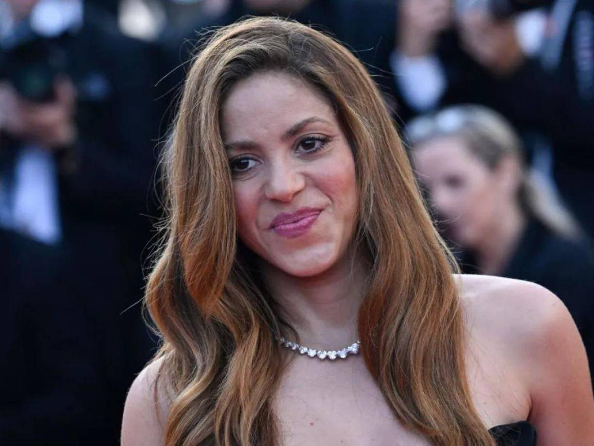 Confesó que cuando tenía piojos su mamá se los mataba con Baygon 